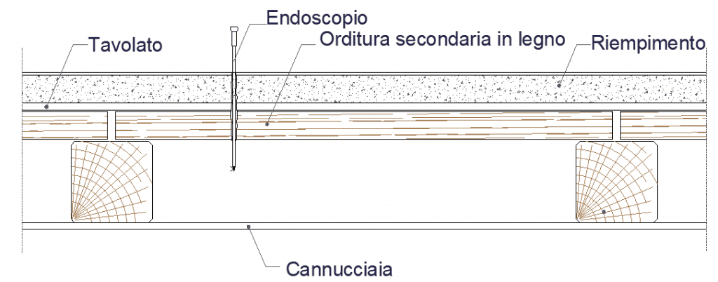 endoscopia